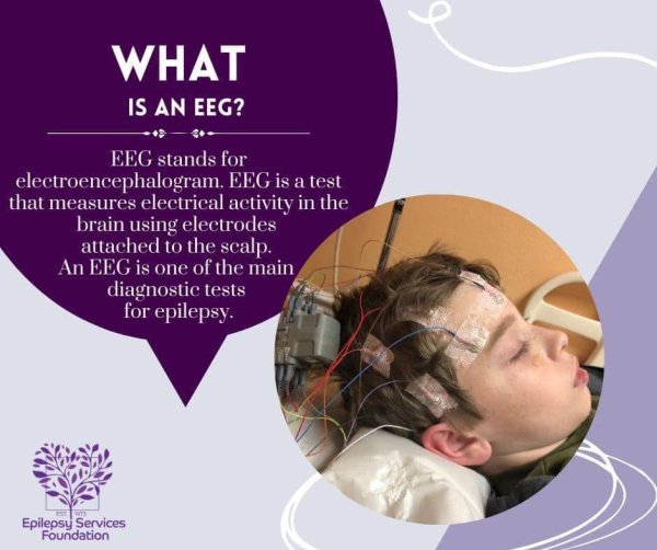 EEG EEG